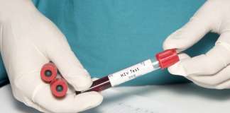 Record pentru Olt de noi cazuri pozitive de HIV